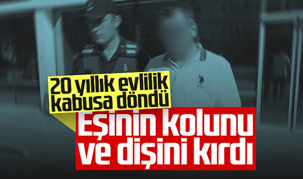 Samsun'da 20 Yıllık Evlilik Kabusa Döndü! Eşinin Kolunu ve Dişini Kırdı