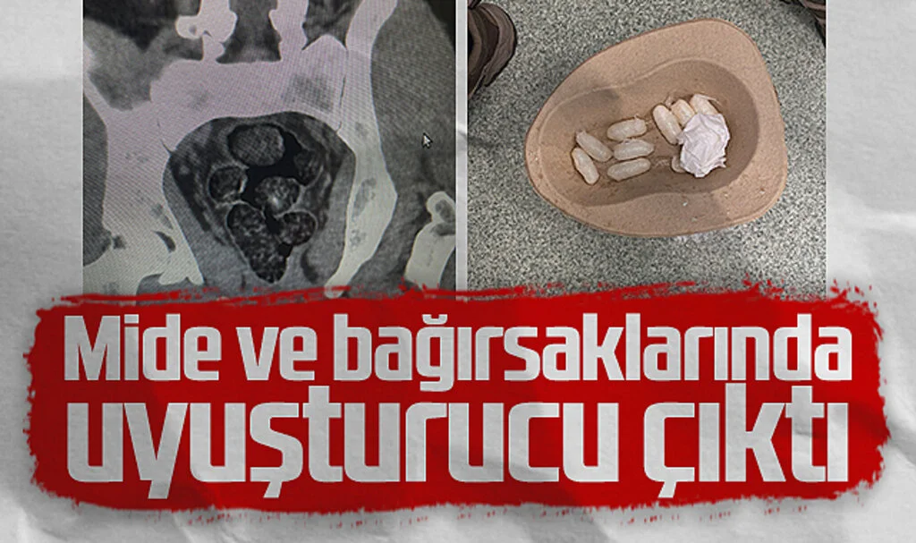 Samsun'da Midesinde Uyuşturucu Taşıyan İranlı Zanlı Yakalandı
