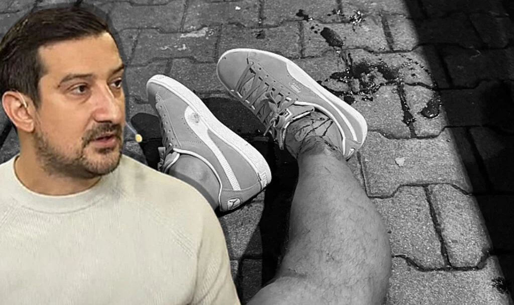 Serhat Akın’a Silahlı Saldırı