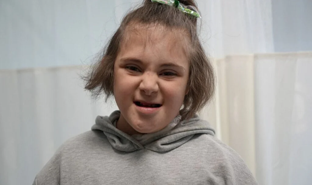 Down Sendromlu Elif’in Yüzü Epilepsi Pili ile Gülecek