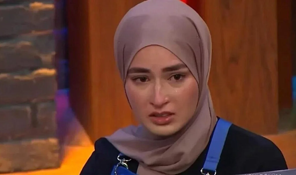 MasterChef Beyza'nın Yüzü Yandı!