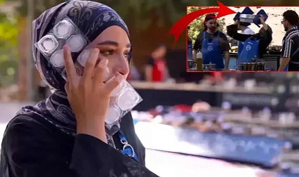 MasterChef Türkiye’de Talihsiz Kaza: Beyza’nın Yüzüne Sıcak Yağ Döküldü