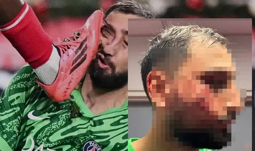 Donnarumma’ya Yapılan Faul Futbol Dünyasını Sarstı