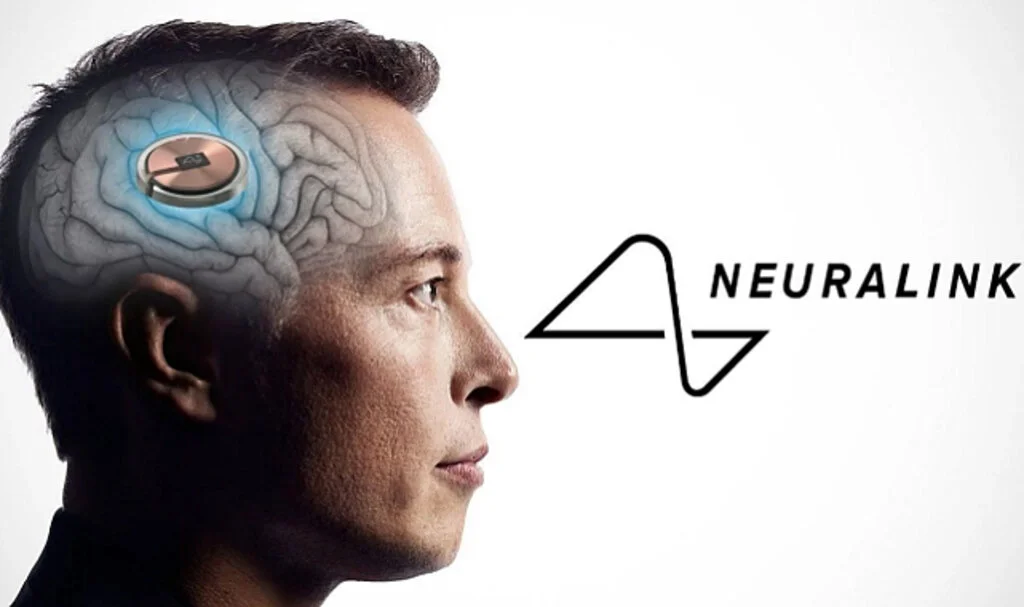 Elon Musk'ın şirketi hastanın beynine çip yerleştirdi
