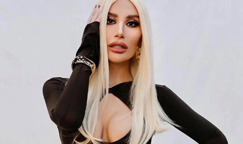 İrem Derici Kaza Geçirdi: Hastaneye Kaldırıldı