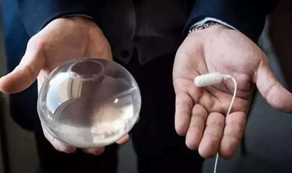 Sağlık Bakanlığı, Mide Balonu Uygulamasını Geçici Olarak Durdurdu