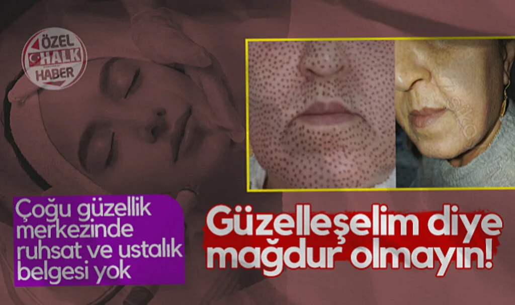 Çoğu Güzellik Merkezinde Ruhsat ve Ustalık Belgesi Yok! Güzelleşelim Diye Mağdur Olmayın