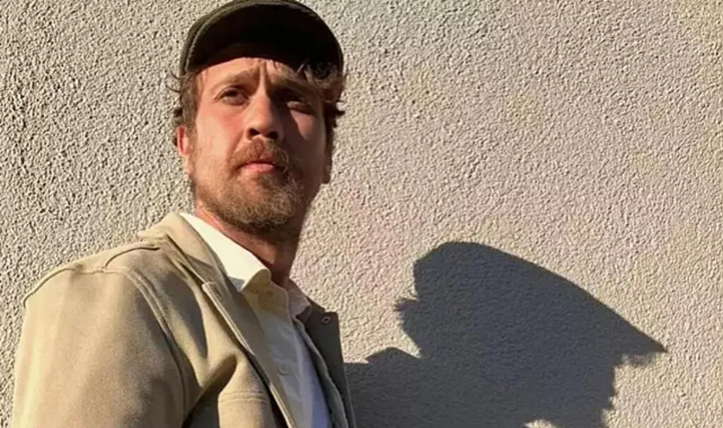 Aras Bulut İynemli Set Kazası Geçirdi! Ameliyat Oldu