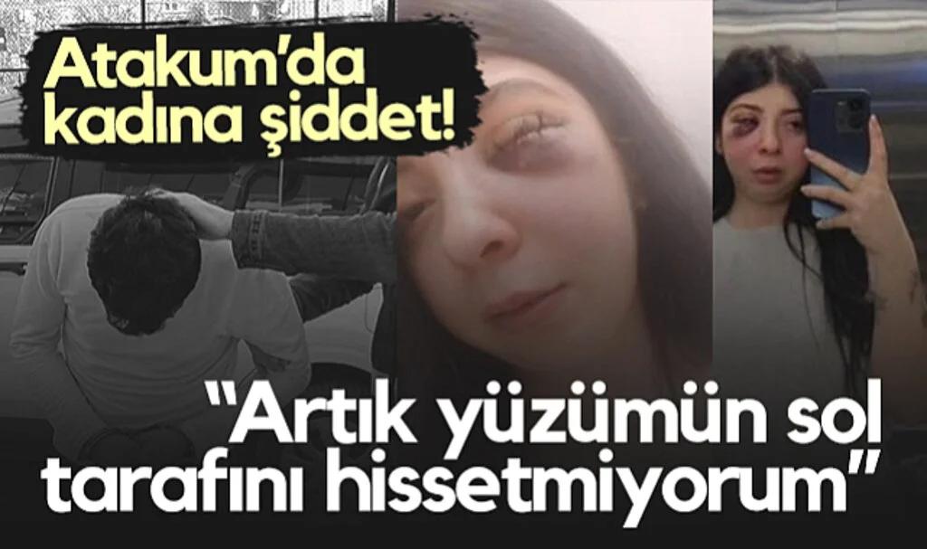 Atakum’da Sokak Ortasında Kadına Şiddet: “Artık Yüzümün Sol Tarafını Hissetmiyorum”