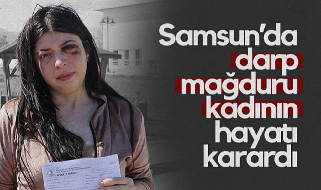 Samsun’da Darp Mağduru Kadının Hayatı Karardı: Öyle Bir Ceza Alsın ki Herkese Ders Olsun