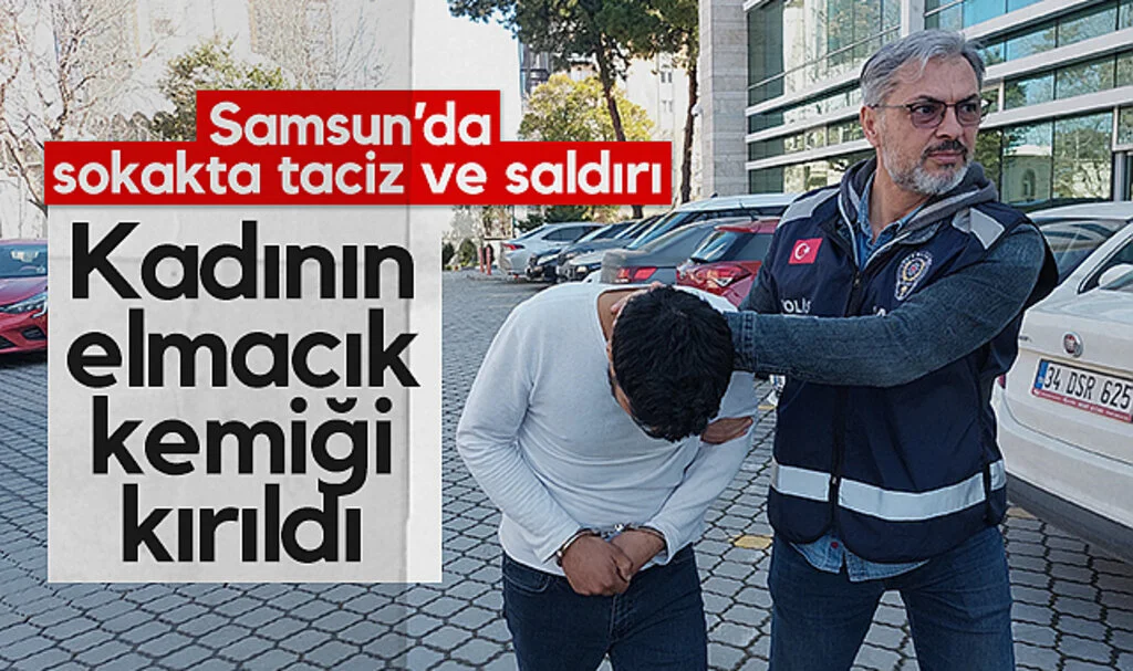 Samsun’da Sokakta Taciz ve Saldırı: Kadının Elmacık Kemiği Kırıldı
