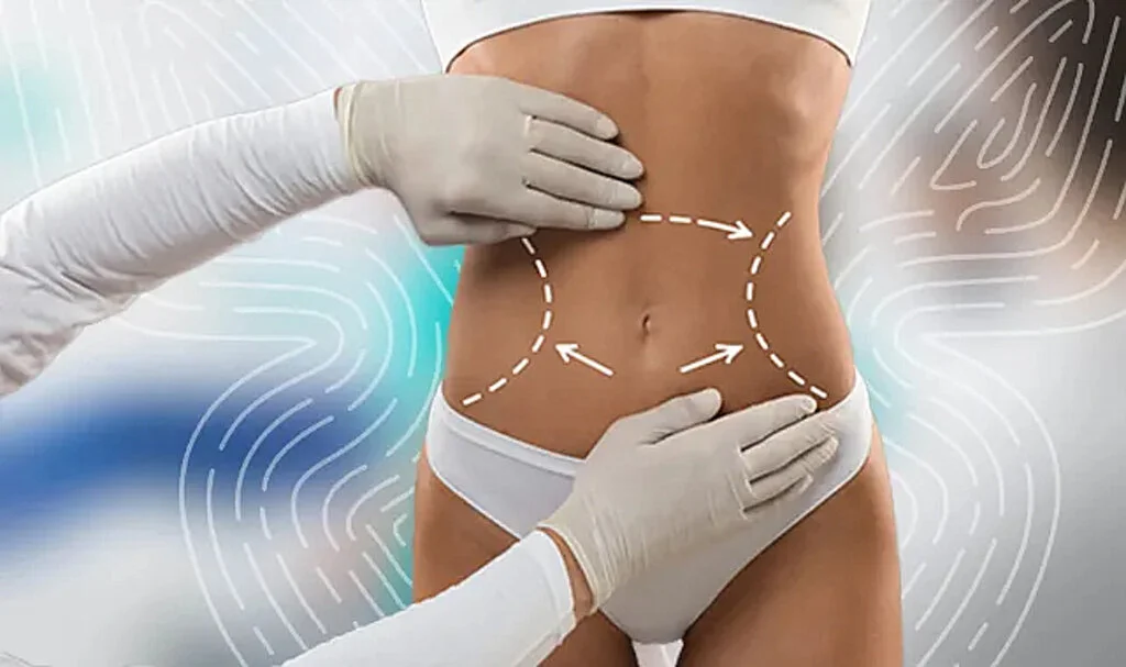 Karın Germe (Abdominoplasti) Ankara: Şekilli ve Düzgün Bir Karın İçin Profesyonel Çözümler