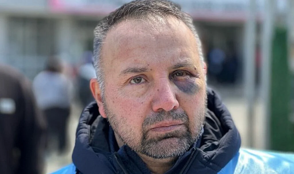 Samsun'da Darp Edilen Öğretmen Konuştu: Ben Kahraman Değilim