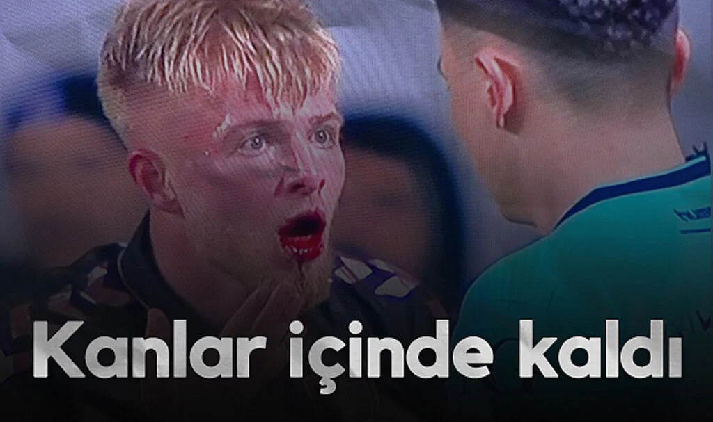 Samsunspor'un Hollandalı Stoperi Drongelen Kanlar İçinde Kaldı!
