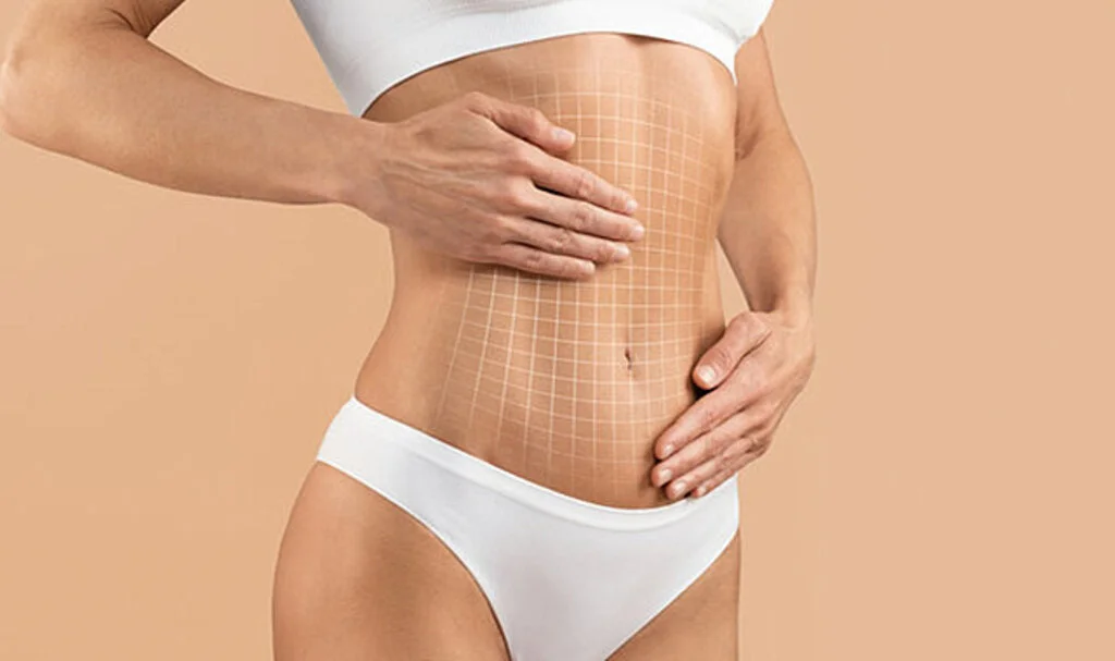 Liposuction ile Bölgesel Yağlardan Kalıcı Kurtuluş
