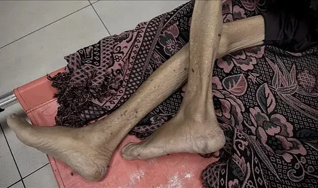 Gazze’de Açlıktan Ölümler Artıyor: 3’ü Çocuk 10 Kişi Daha Yaşamını Yitirdi