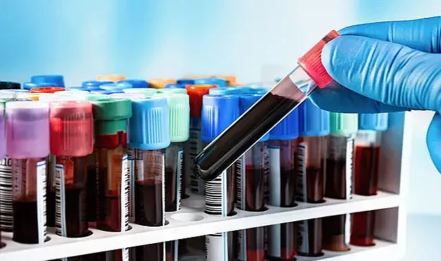 Hangi Kan Testleri Gerçekten İşe Yarıyor?