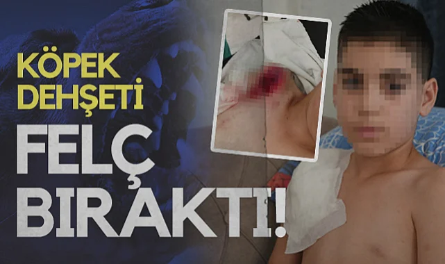 Samsun'da Köpek Dehşeti! Kolu Felç Kaldı