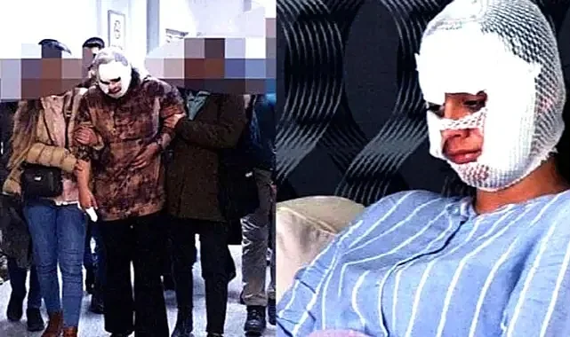 "Seni Bergen Gibi Yapacağım" Diyen Eşe Neden İndirim Uygulandı? Yüzü Parçalanan Kadının İfadeleri
