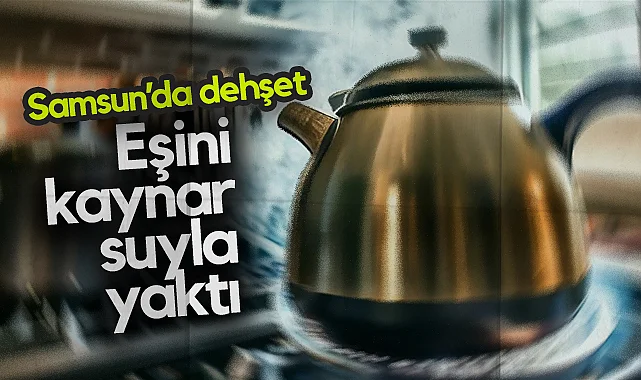 Samsun’da Dehşet: Koca Tartıştığı Eşini Kaynar Suyla Yaktı