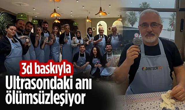 3d Baskıyla Ultrasondaki Anı Ölümsüzleşiyor