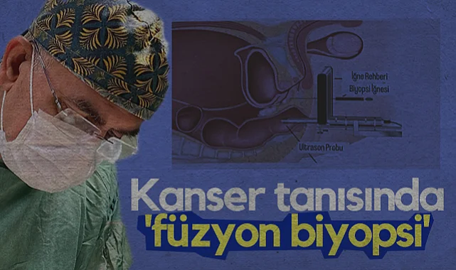 Prostat Kanserinde Akıllı Tanı Dönemi: Füzyon Biyopsisi İle Başarı Oranı %90'a Çıktı