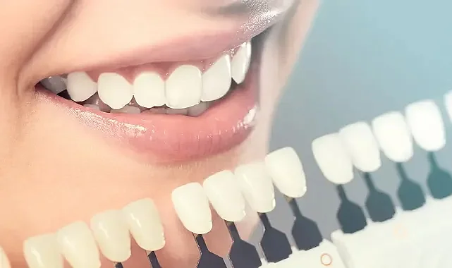 Estetik ve Dayanıklı Gülüşler İçin Zirkonyum ve Porselen Kaplama Rehberi