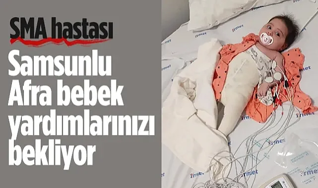 Samsunlu Afra Bebek Yardımlarınızı Bekliyor
