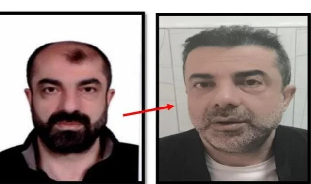 Ameliyatla Yüzünü Değiştiren Firari Cinayet Zanlısı 7 Yıl Sonra Yakalandı
