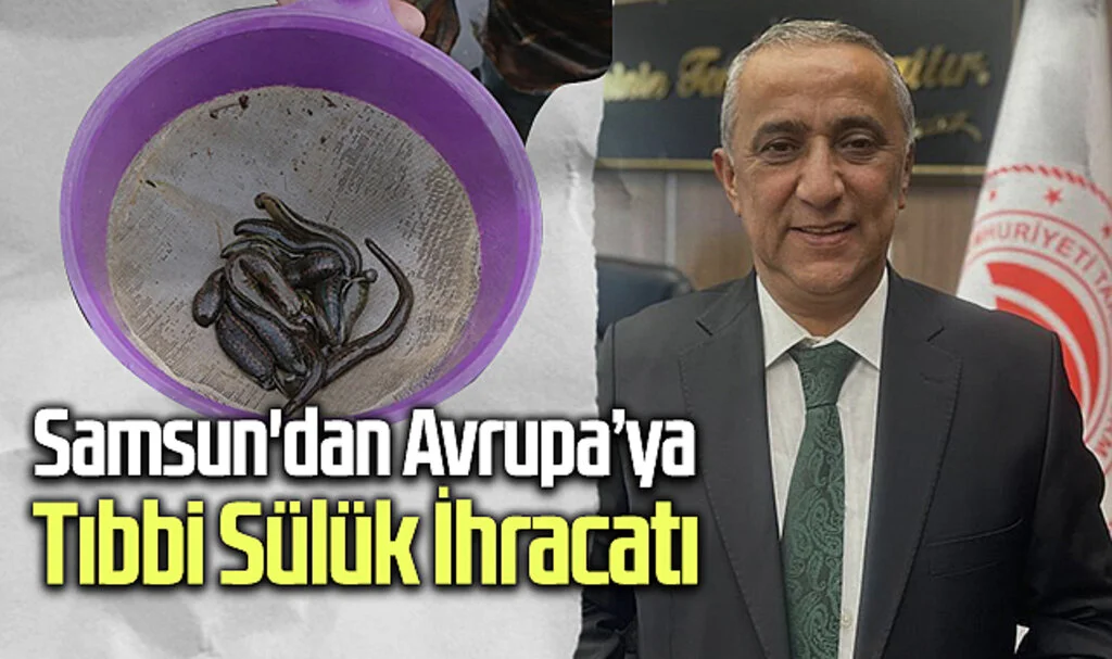 Samsun'dan Avrupa ve Uzak Doğu'ya Tıbbi Sülük İhracatı