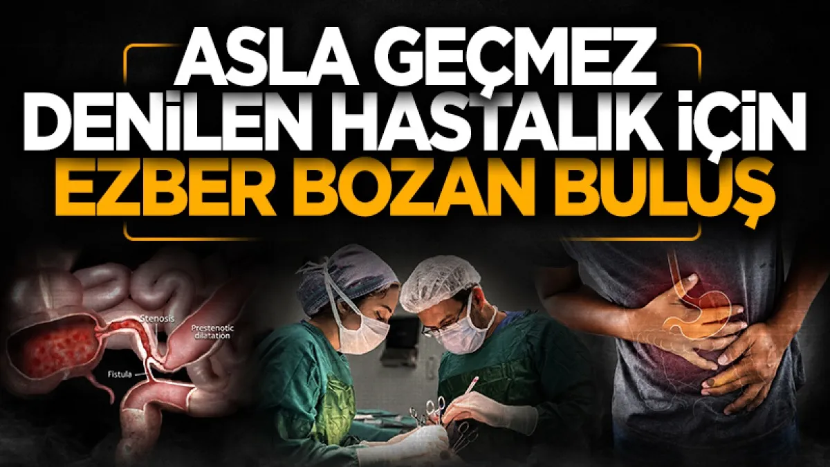 Crohn hastalığında kesin tedavi arayışında ezber bozan buluş: Kanserin ilacı çare mi oluyor?