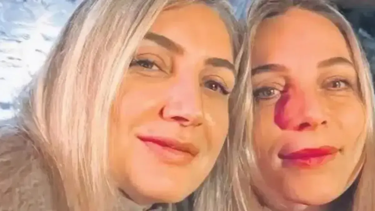 Dilek Kaya İmamoğlu'nun yeğeni Derya Dağdeviren tahliye edildi!