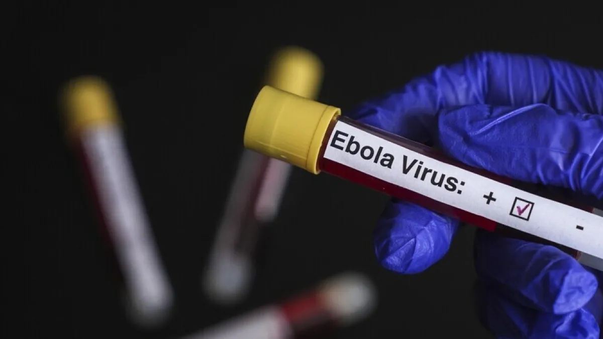 DSÖ açıkladı: Ebola salgınında 896 vaka bildirildi
