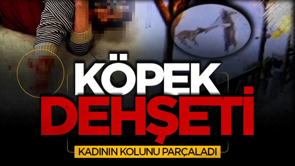 Köpek dehşeti! Kadının kolunu parçaladı