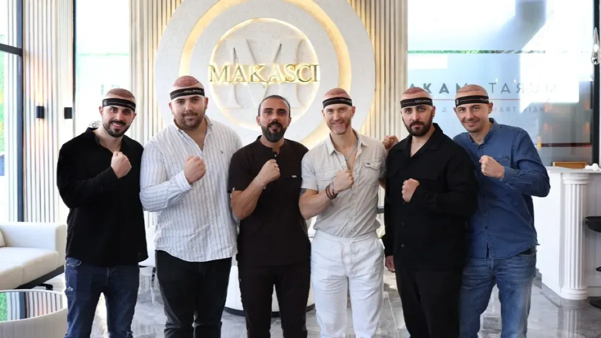 Saç Ekimi Kararı Nasıl Verilir? Murat Makascı’dan Doğal Sonuç İçin Planlama Rehberi
