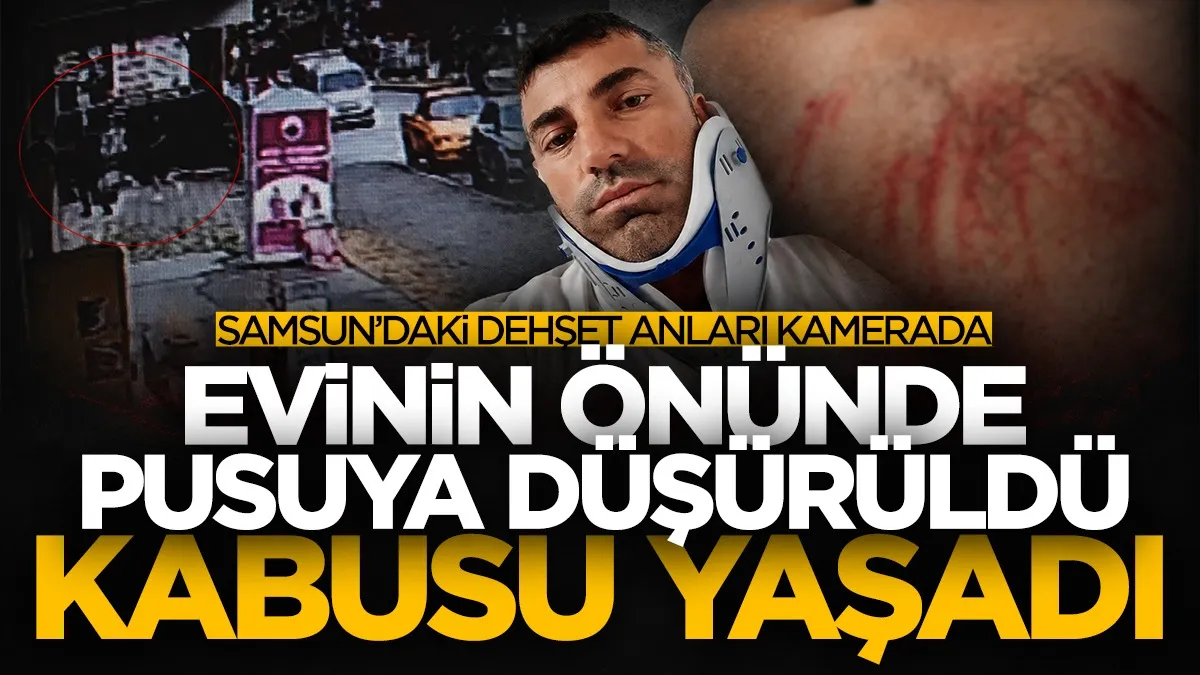 Samsun’da evinin önünde pusuya düşürülüp sopalı saldırıya uğradı! O anlar kamerada...