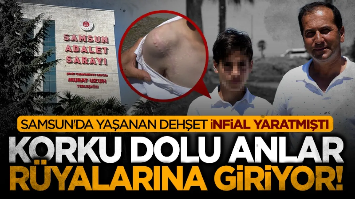 Samsun’da köpek saldırısında omzu parçalanan Yunus’un ilk duruşması yapıldı
