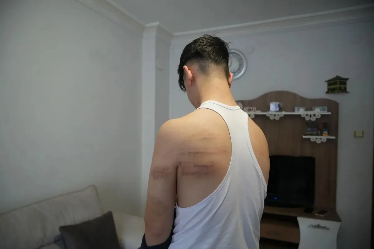 15 yaşındaki çırak için darp iddiası!